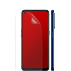 Matte Screen OnePlus Nord N20 5G